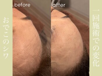 健志接骨院/πテラピー造顔メソッド