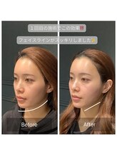 サリエ(S'allier)/お客様のビフォーアフター