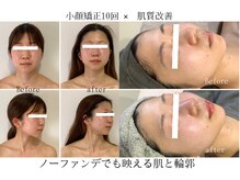 サロンメロウ 大牟田店(salon mellow)の雰囲気（小顔矯正×肌質改善、最短3ヶ月で近距離も写真も自信に変わる）
