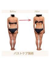 サロンソワ(salon Soi.)/NRナインバストアップケア