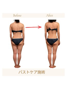 サロンソワ(salon Soi.)/NRナインバストアップケア
