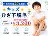 【体育の授業も怖くない】★キッズ【ひざ下脱毛】★毎月20名限定20%OFF￥3200