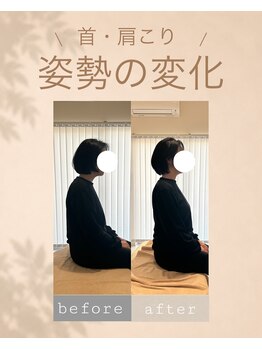 アオ 香椎(AO)/before→after