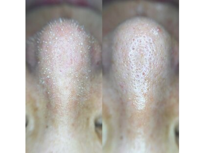 アモリアージュ(Amolliage)の写真