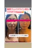McCOY認定技術！《筋膜BODYストレッチ》×《筋膜小顔術》22000円→16000円
