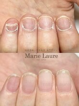 マリーロール 梅田店(Marie Laure)/自爪育成/深爪矯正/ネイルケア