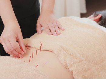 フォーユー鍼灸整骨院 かつらぎ院(for you 鍼灸整骨院)/【手では届かない最深部を施術】