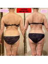 アユスリム(AYU SLIM)/一回でも変化できるの充実痩身