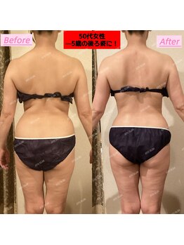 アユスリム(AYU SLIM)/一回でも変化できるの充実痩身