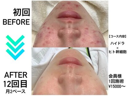 リンフェイス 横浜店(RINFACE)の写真