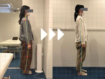 ミライズ整体院 三宮本院/事例【20代女性・姿勢】