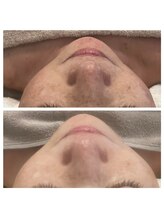 美温(mion)/極み180 フェイシャルケア