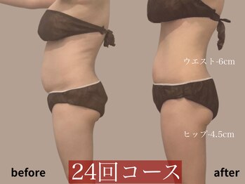 モア 多治見店(MORE)/お客様ビフォーアフター