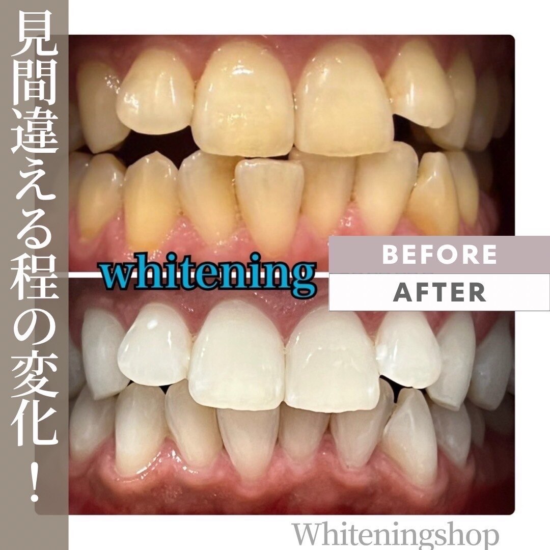 ホワイトニングショップ 亀岡店｜ホットペッパービューティー