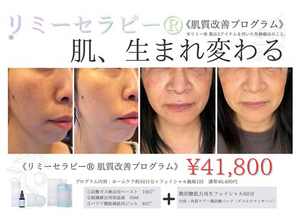 ムーア(muua)の写真