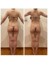 ワンモア(ONEMORE)/