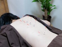 ～女性専用～四季の声 はりきゅう治療院 横浜鶴見[妊活/美容鍼/マタニティ/鍼灸整体]/施術【妊活/美容鍼/鍼灸整体】