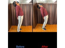 やぎはし整体院 柏駅西口店/腰痛整体のビフォーアフター