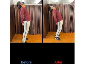 やぎはし整体院 柏駅西口店/腰痛整体のビフォーアフター