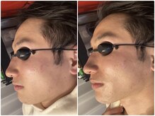 バース(Birth...)/光フォトの効果がすごすぎる