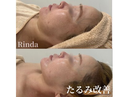 リンダ(Rinda)の写真