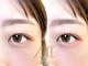 アミカ(amica)の写真
