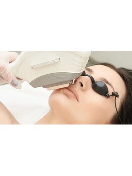 顔脱毛がしたい