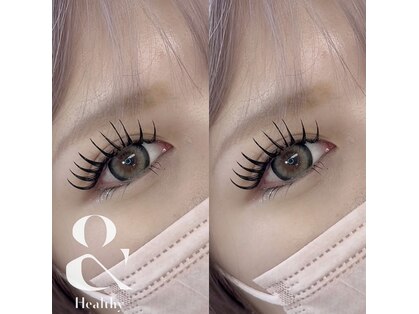 ビセイ(Bisei)の写真