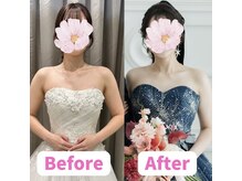 ボディキュア ブライダル美容整体 大阪梅田/フェイスラインも引き締め/大阪