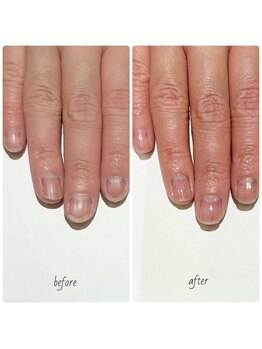 エヌドットバーバーヒロオ ネイル(N.BARBER HIROO)/3ヶ月の自爪育成プログラム