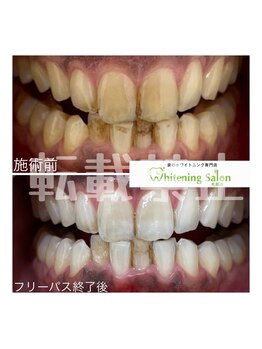 ホワイトニングサロン 札幌店/【ホワイトニングスタッフ】