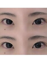 シーンスタジオ 原宿店(SSIN STUDIO)/まつげパーマ/原宿店/マツパ