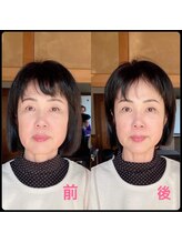 わたしの/小顔矯正