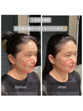 サリエ(S'allier)/お客様のビフォーアフター