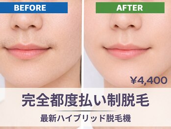 フルーブラン(Frubran)/【女性】顔脱毛で毛穴目立ちゼロ