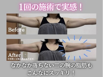 ルナ(LUNA)の写真
