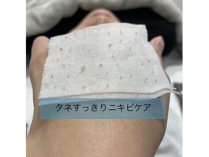 スキン ラボ ケー(Skin lab K)の写真