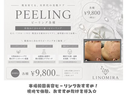 リノミラ(LINOMIRA)の写真