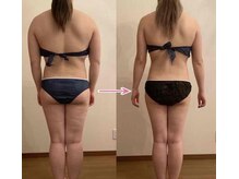 美宝 元町の雰囲気（最新アイスナイフW【脂肪減少＋全身】だから－３kg～２０kg痩せ!）