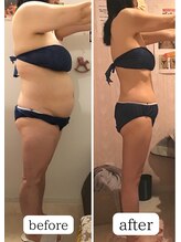 アンリール/人気の痩身コース