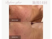 パルタージュ(Partage)/オーダーメイドプログラム★