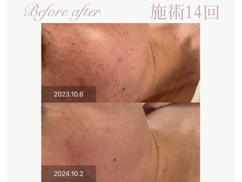 パルタージュ(Partage)/オーダーメイドプログラム★