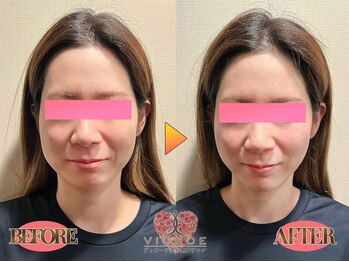 ヴィオーデ美容整体サロン 横浜店/小顔、リンパ、ヘッドスパ、整体