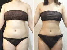 美容整体ウェリナ 名駅院/小顔矯正/骨盤矯正/痩身整体