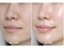 ティンク 心斎橋(Tink)