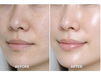 ティンク 心斎橋(Tink)