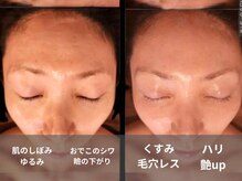 シェノン(Chainon)