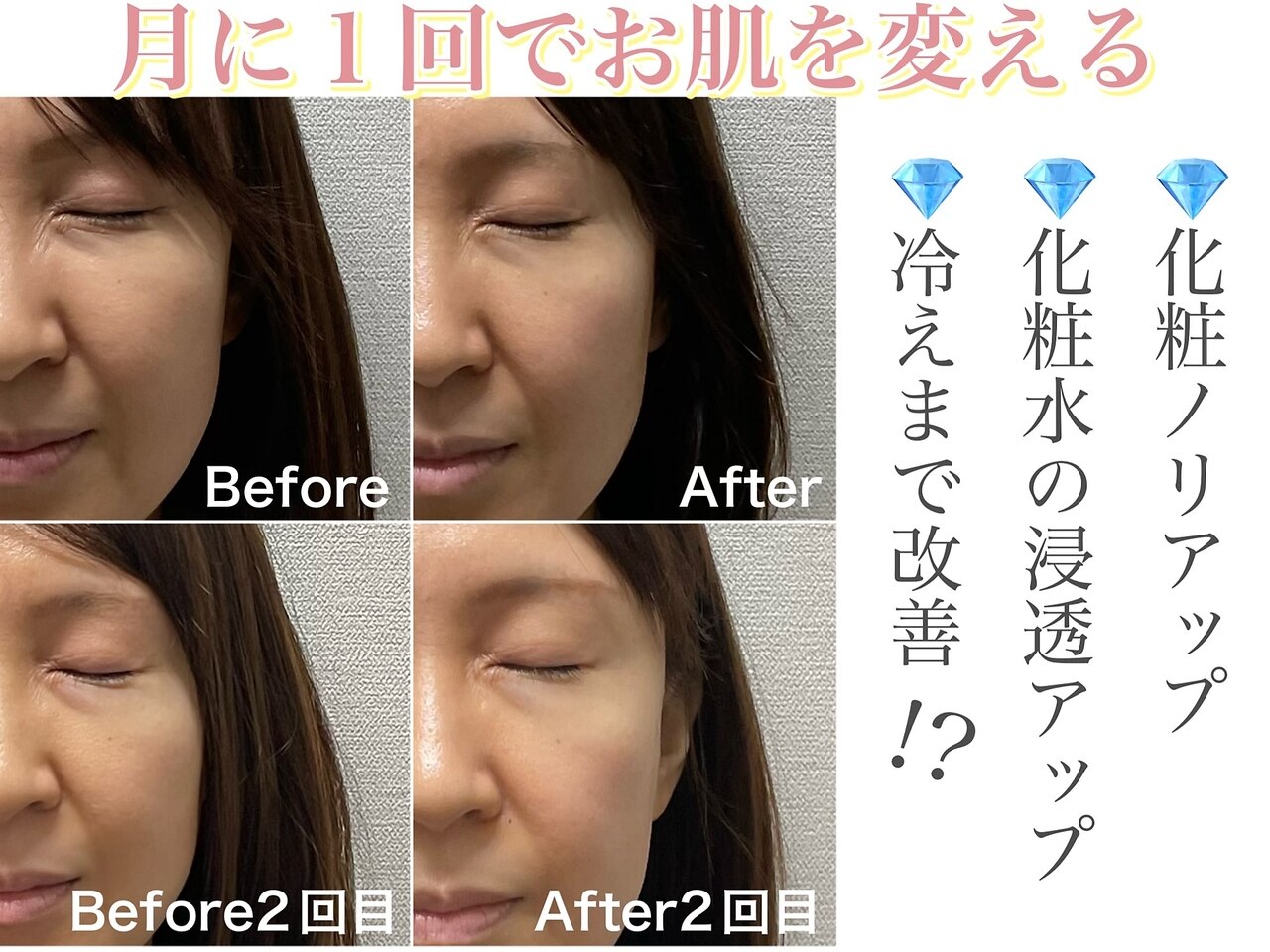 ミムー｜ホットペッパービューティー