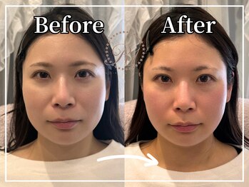 R-1ビューティーサロン 銀座/Before&After