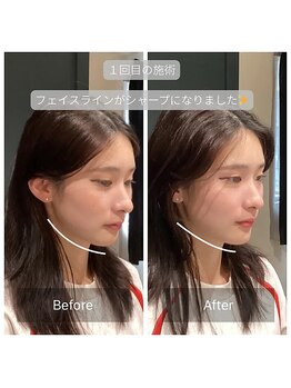 サリエ(S'allier)/お客様のビフォーアフター